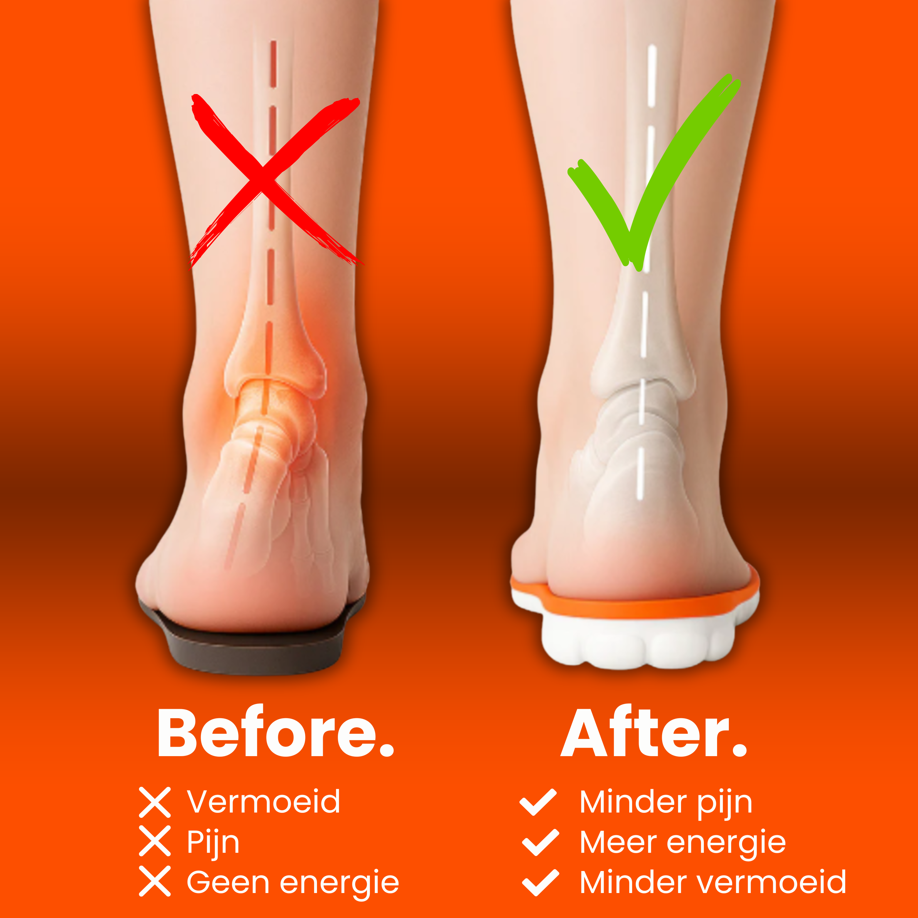 Solefy® - Massage Einlegesohlen 